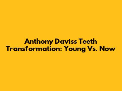 Anthony Davis's Teeth Transformation: Young Vs. Now