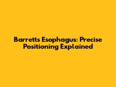Barrett's Esophagus: Precise Positioning Explained