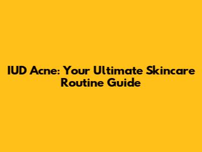 IUD Acne: Your Ultimate Skincare Routine Guide